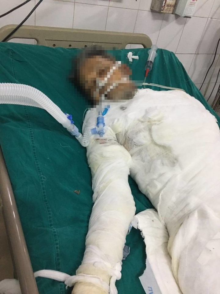 Người đàn ông ở Hà Nam tự thiêu nghi do không đồng tình 2 bản án - 1