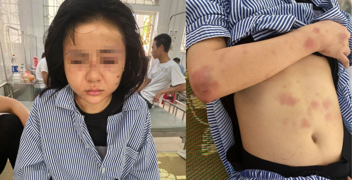 Cô gái bị kẻ yêu đơn phương túm tóc, tát bò lê bò càng tại nhà riêng - 1