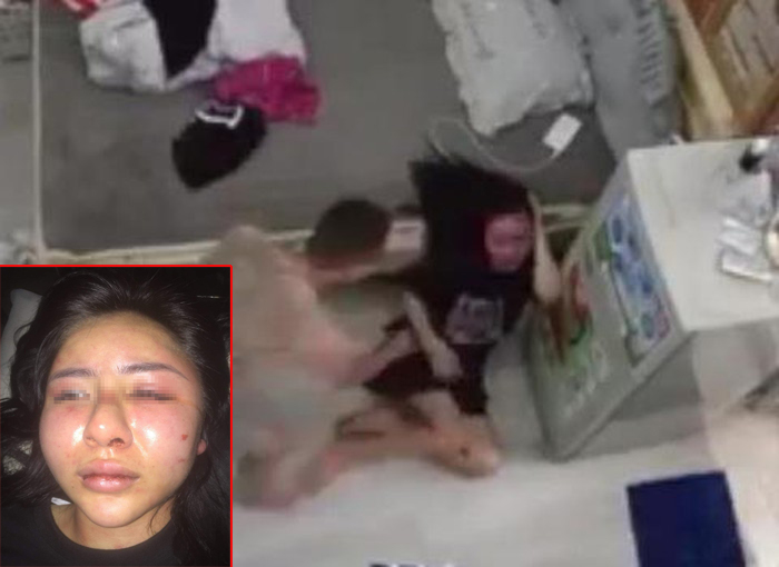 Kẻ cuồng yêu đánh cô gái dã man: Hội Phụ nữ tỉnh Yên Bái đề nghị xử nghiêm - 1