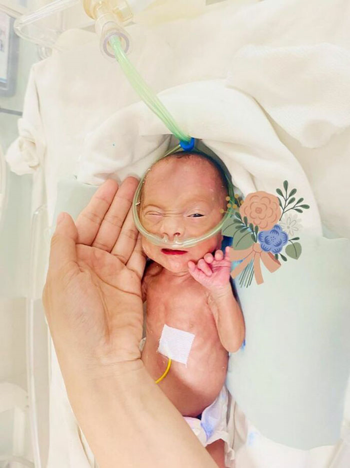 Vợ chồng 14 năm hiếm muộn, sinh con nặng 600g và 76 ngày giành sự sống cho bé - 2