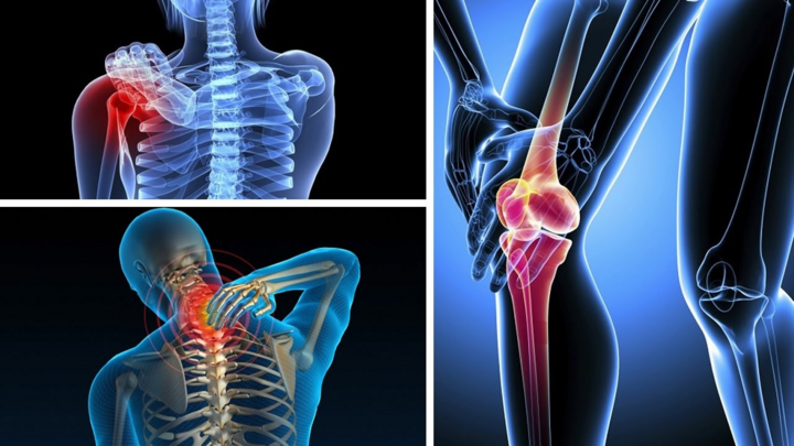 Sản phẩm hỗ trợ điều trị bệnh xương khớp Phục Cốt Linh có tốt không? - 3