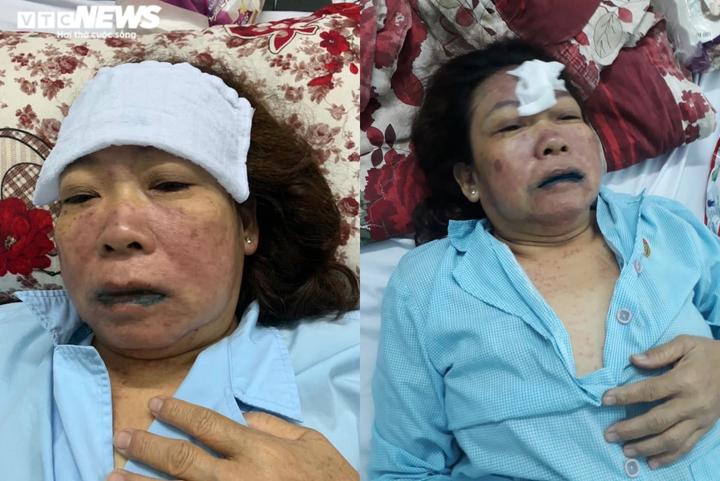 Uống thuốc do bác sĩ Bệnh viện Sài Gòn ITO kê, người phụ nữ suýt mất mạng - 1