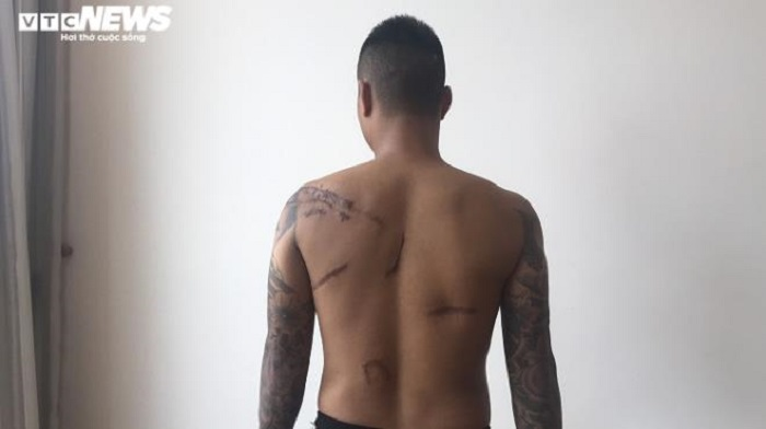 Khởi tố vụ án đàn em Đường 'Nhuệ' truy sát nam thanh niên lúc nửa đêm - 2