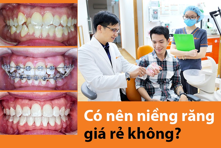 Up Dental: Niềng răng giá rẻ 1 triệu/tháng an toàn, uy tín - 1