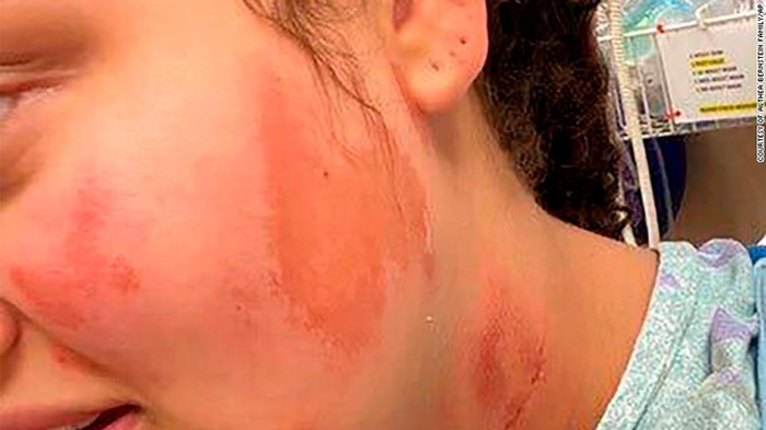 Thiếu nữ da màu bị nhóm phân biệt chủng tộc châm lửa đốt trên phố - 2