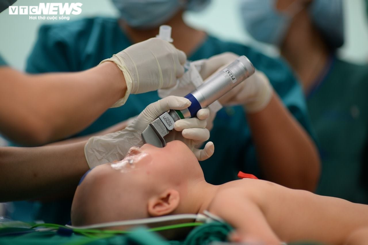 CẬP NHẬT: Đã tách rời cặp song sinh dính liền - 2