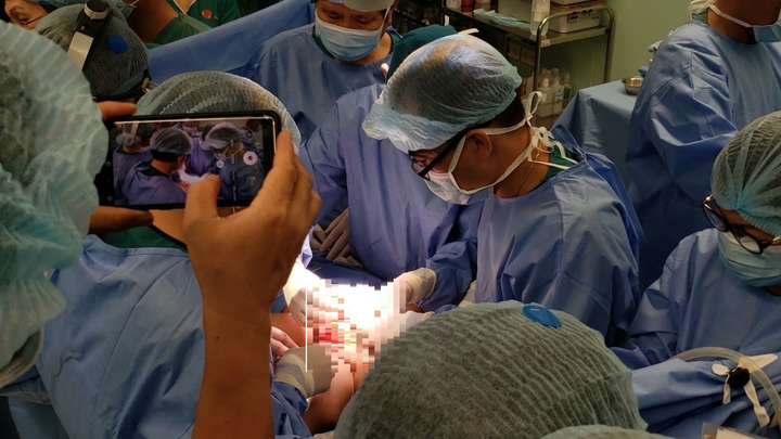 13 tháng dính nhau và 13 tiếng kỳ diệu tách rời cặp song sinh Trúc Nhi-Diệu Nhi - 5