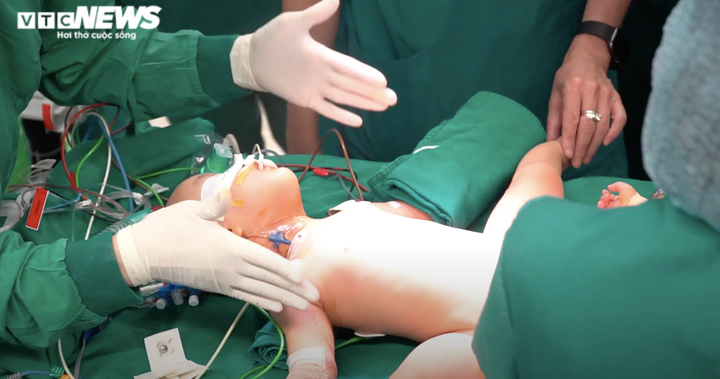 Hơn 6 tiếng trong phòng phẫu thuật, sức khỏe cặp song sinh dính liền ra sao? - 4