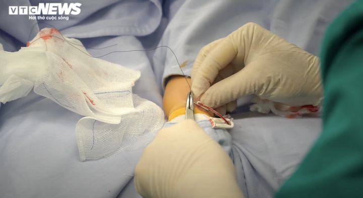 Hơn 6 tiếng trong phòng phẫu thuật, sức khỏe cặp song sinh dính liền ra sao? - 5