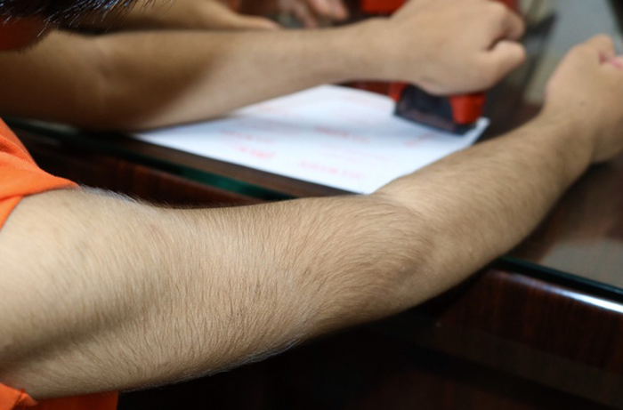 Bé gái 6 tuổi ở Vũng Tàu mắc bệnh hiếm, thế giới chỉ có 74 ca - 2