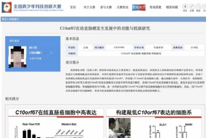 Thần đồng Trung Quốc được bố làm hộ nghiên cứu ung thư đại trực tràng - 1