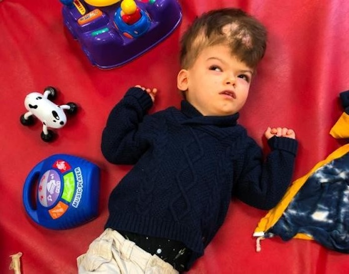 Sau phẫu thuật tách rời, cặp song sinh liền đầu ở Mỹ giờ ra sao? - 4