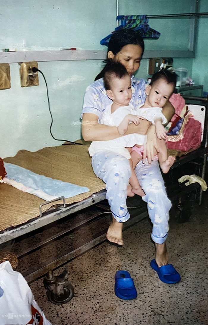 Sau 17 năm mổ tách rời, cặp song sinh dính liền Cúc - An hiện ra sao? - 2