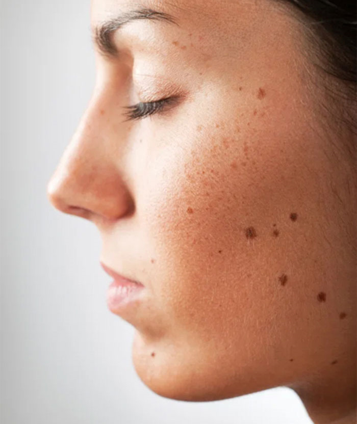Dấu hiệu bất thường nhỏ trên gương mặt cảnh báo vấn đề sức khỏe không nên bỏ qua - 1