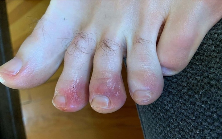 Những bộ phận nào của cơ thể dễ bị virus corona tấn công? - 8