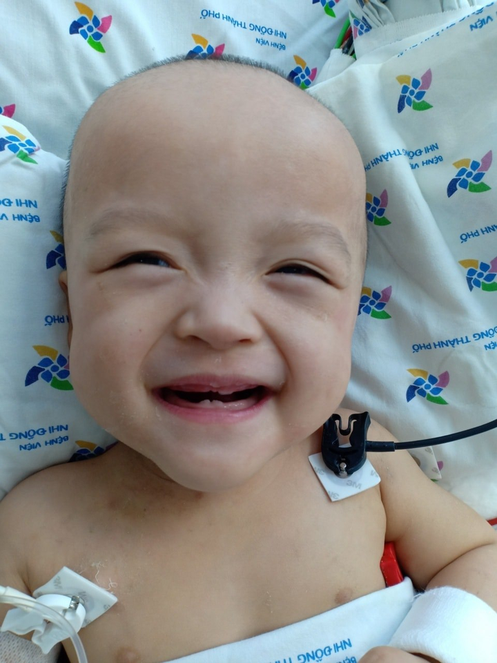 Ảnh: Nụ cười tỏa nắng của cặp song sinh dính liền sau 20 ngày mổ tách rời - 5