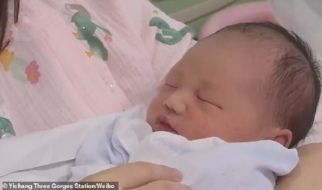 Kỳ lạ bé sơ sinh bị dây rốn quấn 6 vòng quanh cổ - 2