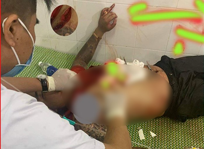 Hỗn chiến ở quán karoke mở 'chui' mùa COVID-19, nhiều người bị chém trọng thương - 1