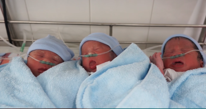 Sản phụ mang tam thai hiếm gặp 'vượt cạn' thành công - 1