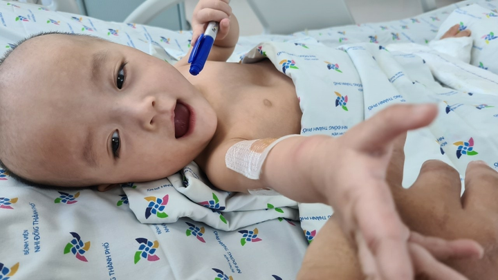 Trúc Nhi - Diệu Nhi sắp được tập đi sau ca mổ tách rời - 1