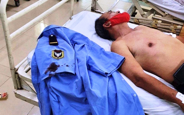 Lời khai của kẻ cầm dao chém loạn xạ bảo vệ chung cư ở TP.HCM - 2