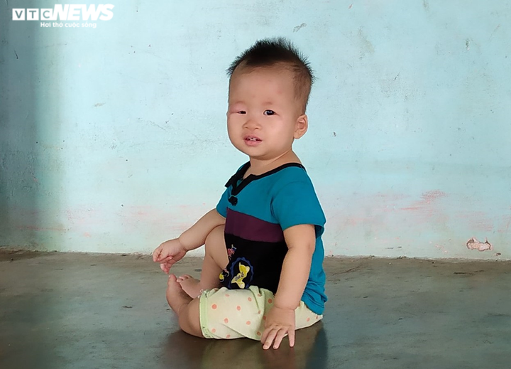 Bé gái 18 tháng tuổi bị bệnh tim, cha mẹ nghèo không có tiền phẫu thuật cho con - 1