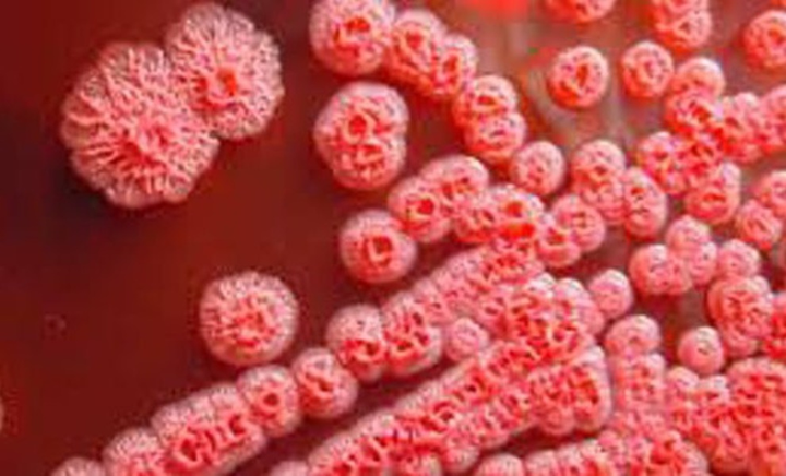 Xét nghiệm COVID-19 lại phát hiện mắc vi khuẩn 'ăn thịt người' - 2