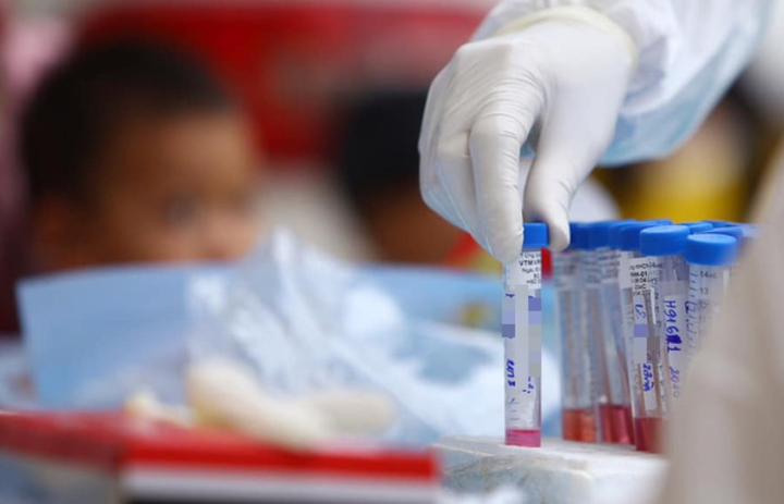 Nam thanh niên ở Hà Nội dương tính với SARS-CoV-2 - 1