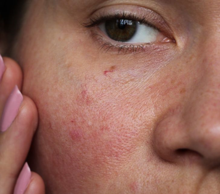 Lợi ích tuyệt vời với sức khỏe nếu bạn tắm nước lạnh mỗi ngày - 5