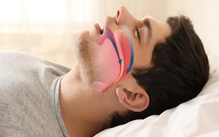 7 căn bệnh phổ biến liên quan đến béo phì - 8