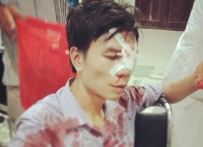 Cán bộ địa chính Nghệ An bị tố lấy cán xẻng đánh người: Chính quyền nói gì? - 1