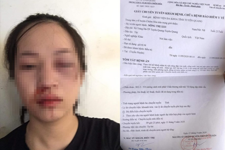 CSGT bị tố vụt gậy vào mặt người phụ nữ đi xe máy: Công an Tuyên Quang lên tiếng - 1