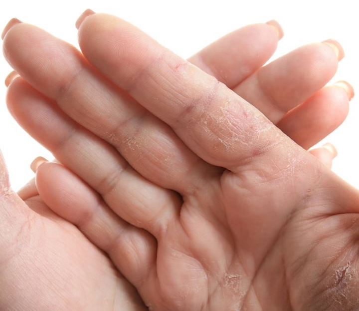 Những thay đổi bất thường trên cơ thể cảnh báo bệnh nguy hiểm - 6