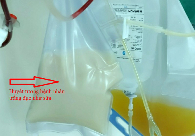 Người phụ nữ có huyết tương trắng đục như sữa - 2