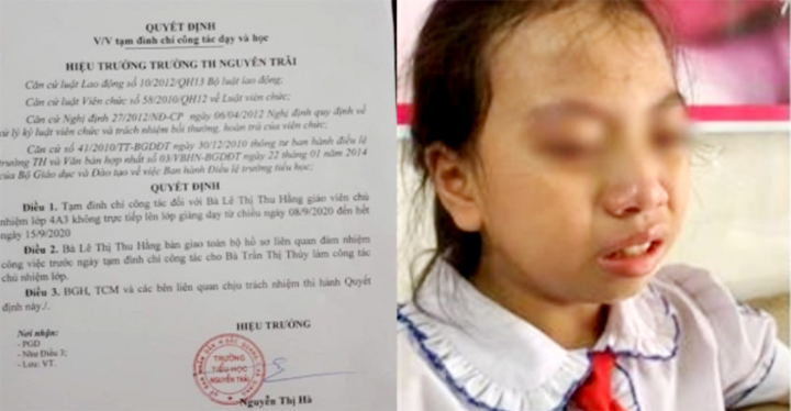 Tát vào má học sinh, cô giáo ở Hà Giang phải ngừng dạy 3 tháng - 1