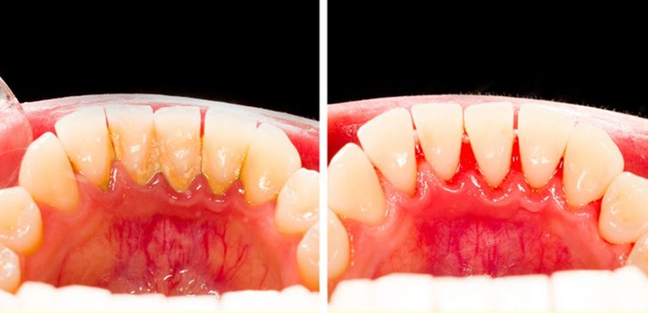 Nhai kẹo cao su có nhiều tác dụng với sức khỏe - 1