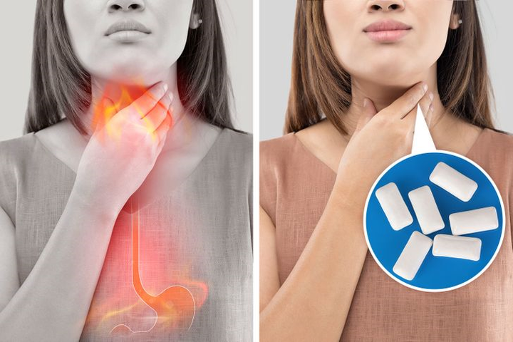 Nhai kẹo cao su có nhiều tác dụng với sức khỏe - 4