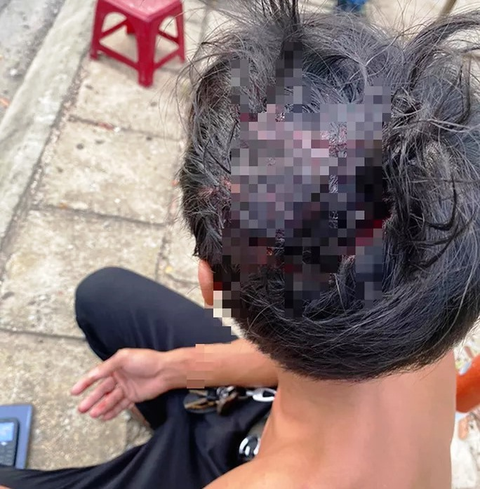 Tranh giành khách tại sân bay, tài xế taxi Vinasun và Mai Linh đánh nhau bể đầu - 1