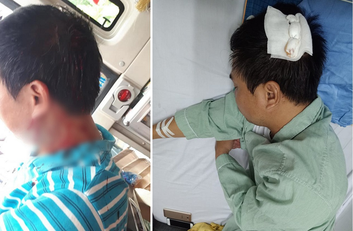 Điều tra nhóm thanh niên cầm tuýp sắt đánh gục phụ xe trên phố Hà Nội - 1