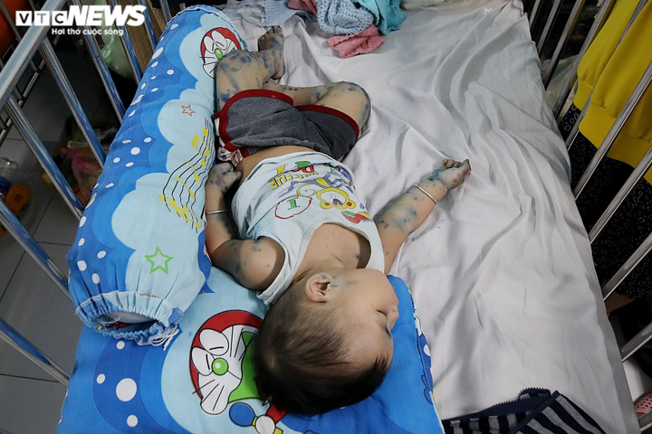 Ảnh: Bệnh chân tay miệng gia tăng nhanh ở TP.HCM - 6