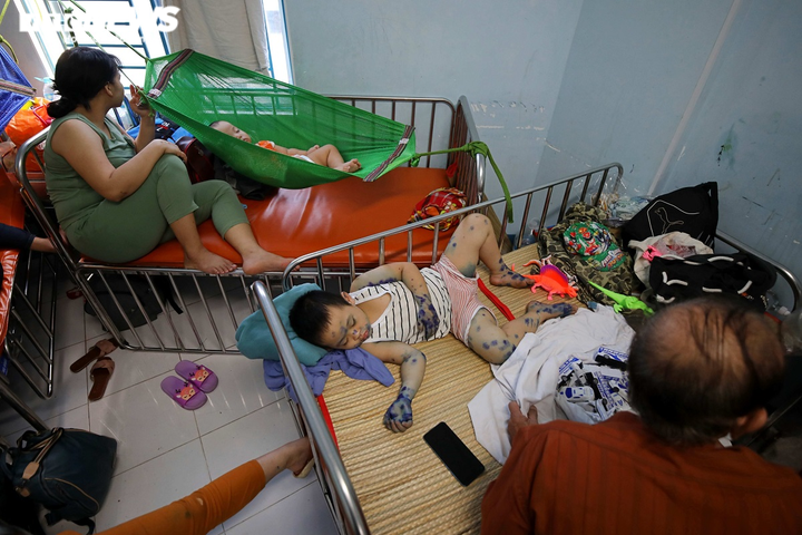 Ảnh: Bệnh chân tay miệng gia tăng nhanh ở TP.HCM - 4