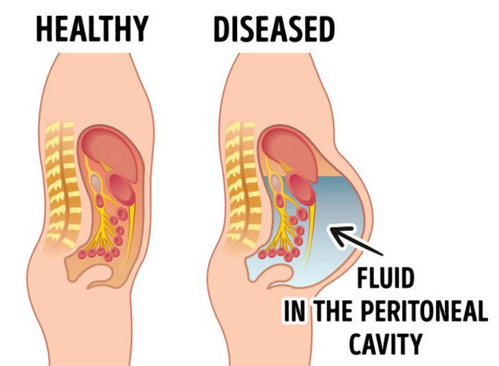 Dấu hiệu cảnh báo bệnh gan - 3