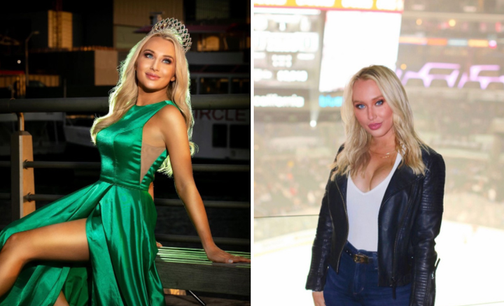 Những hoa hậu từng bị chê 'xấu đau xấu đớn' - 1