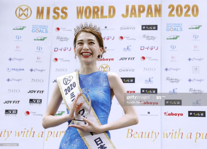 Những hoa hậu từng bị chê 'xấu đau xấu đớn' - 7