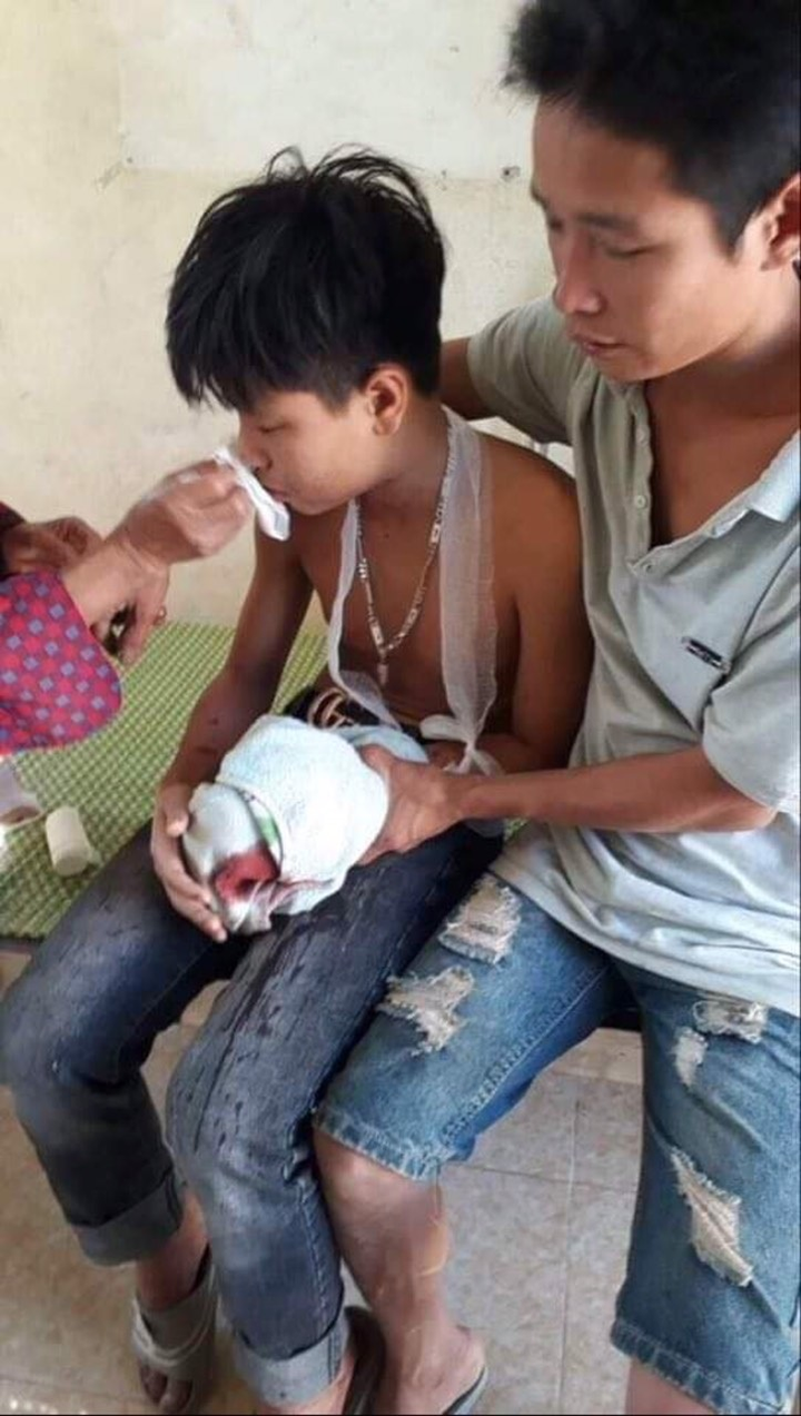 Laptop phát nổ, 3 học sinh ở Hà Tĩnh bị thương - 2