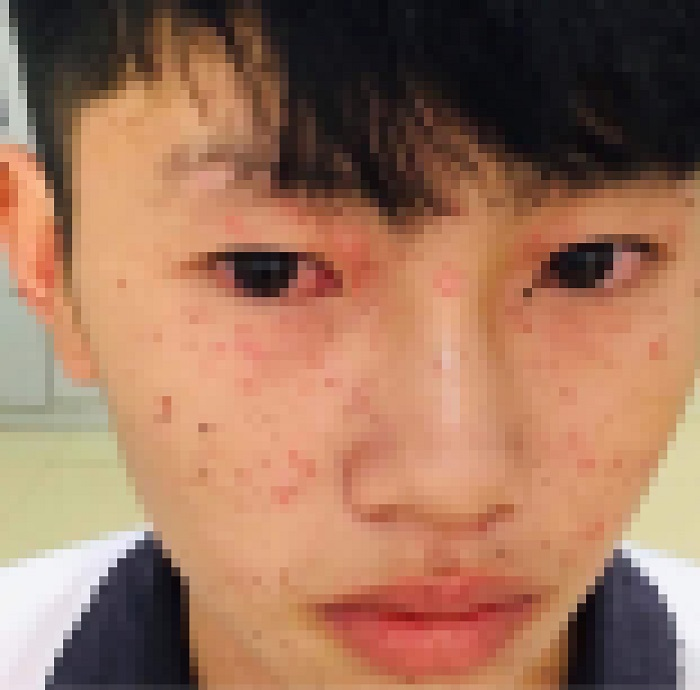 Laptop phát nổ, 3 học sinh ở Hà Tĩnh bị thương - 1