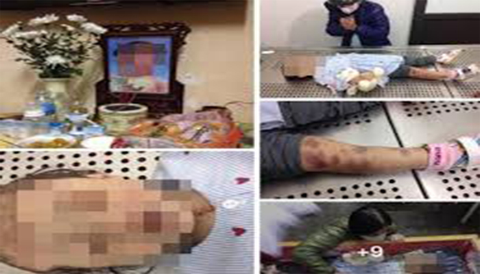 Mẹ đẻ và cha dượng bạo hành bé gái 3 tuổi đến chết bị truy tố khung tử hình - 2