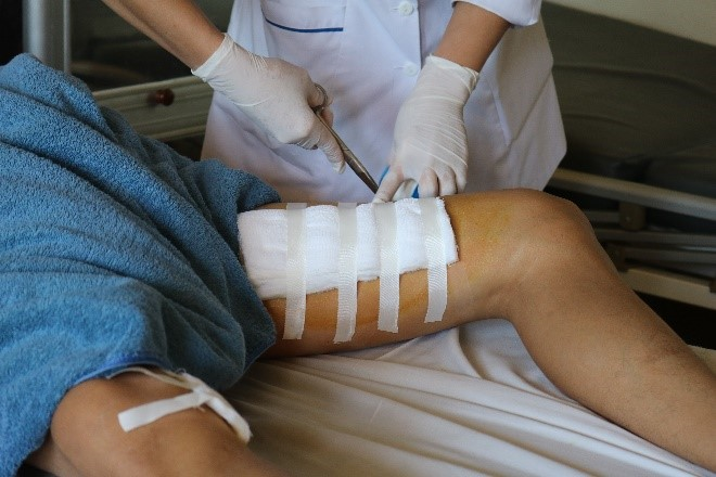 Bình rượu ổi ngâm một năm phát nổ, nam thanh niên bị thương nặng phải cấp cứu - 1