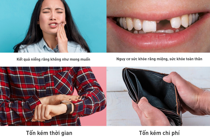 Nhiều cảnh báo niềng răng giá rẻ: Lý do thực sự là gì? - 2