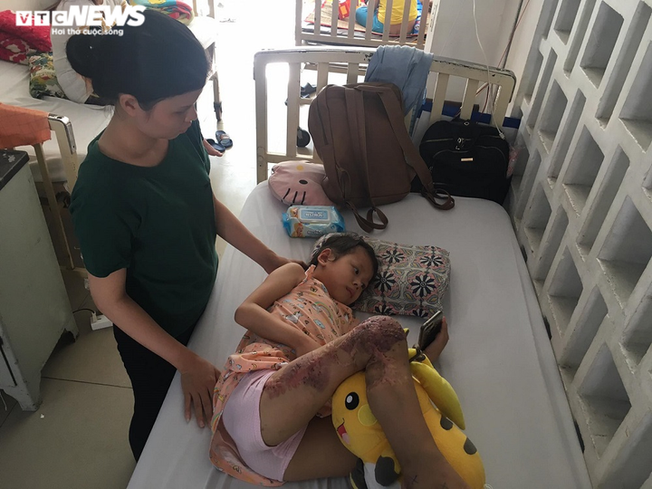 Xót xa nhìn đôi bàn chân bé gái mất 9 ngón sau 18 lần phẫu thuật - 1